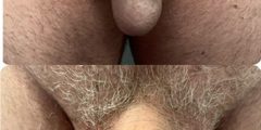 Testicle-enhancement-01