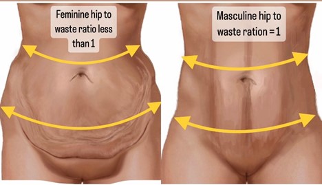 Liposuction & Tummy Tuck In Miami, FL