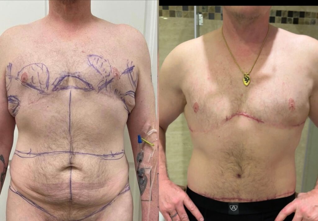 Masculine Body Life Before & After 