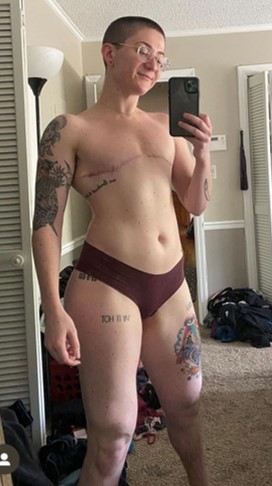 AFAB-Masculoplasty-11