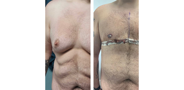 Masculoplasty-Plus-01