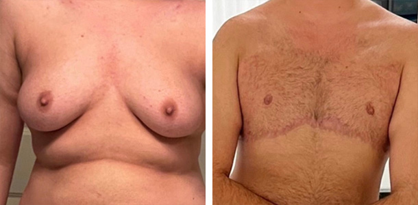 Masculoplasty-Plus-03