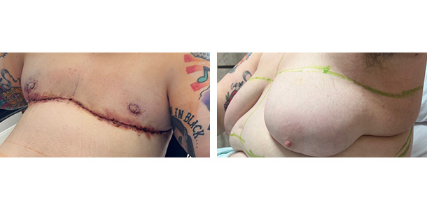 Masculoplasty-Plus-04