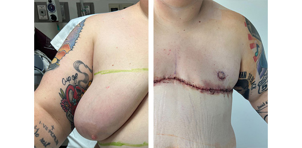 Masculoplasty-Plus-06