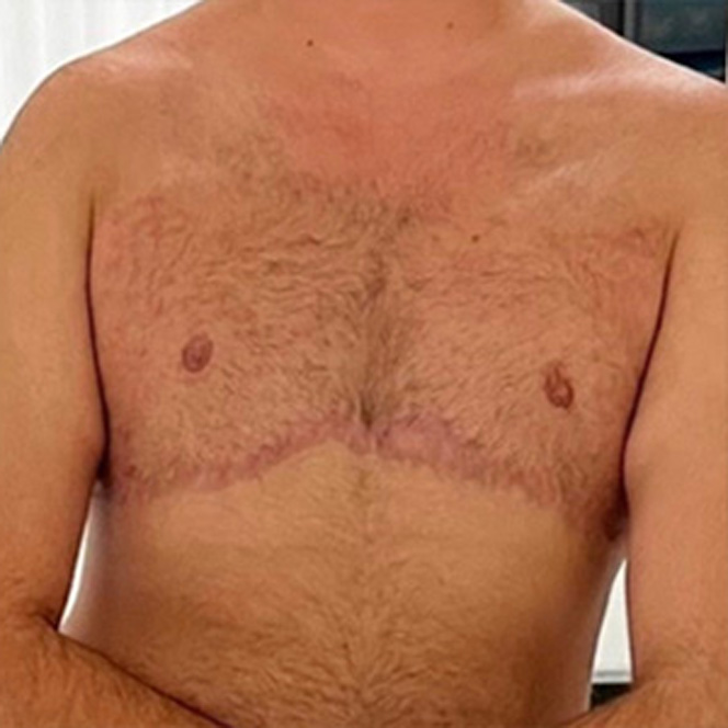 Masculoplasty-Plus-2