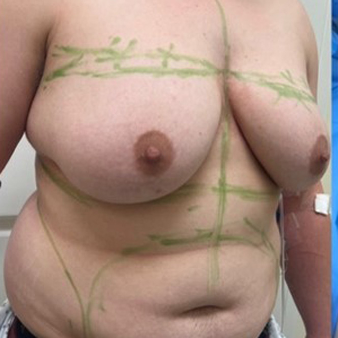 Masculoplasty-Plus-3