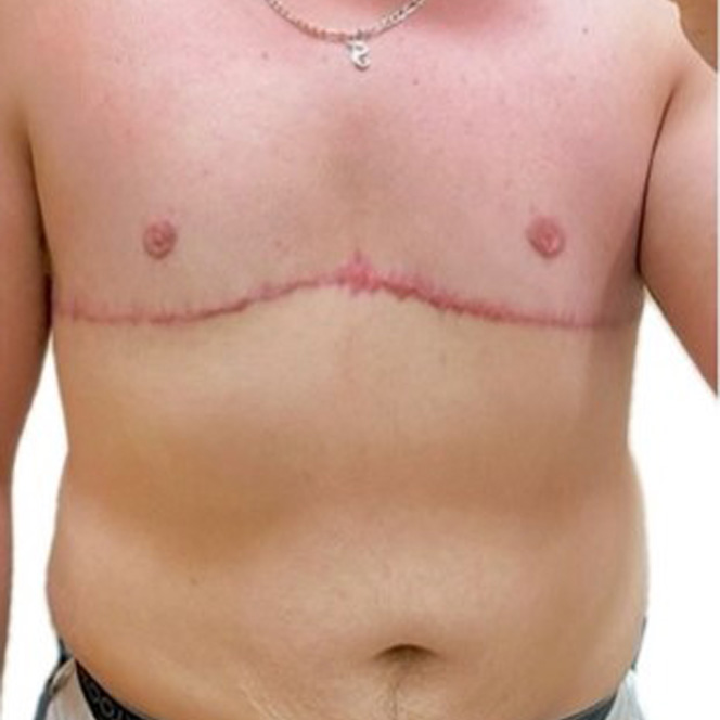 Masculoplasty-Plus-4