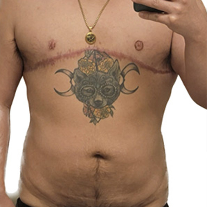 torso-masculinization-2