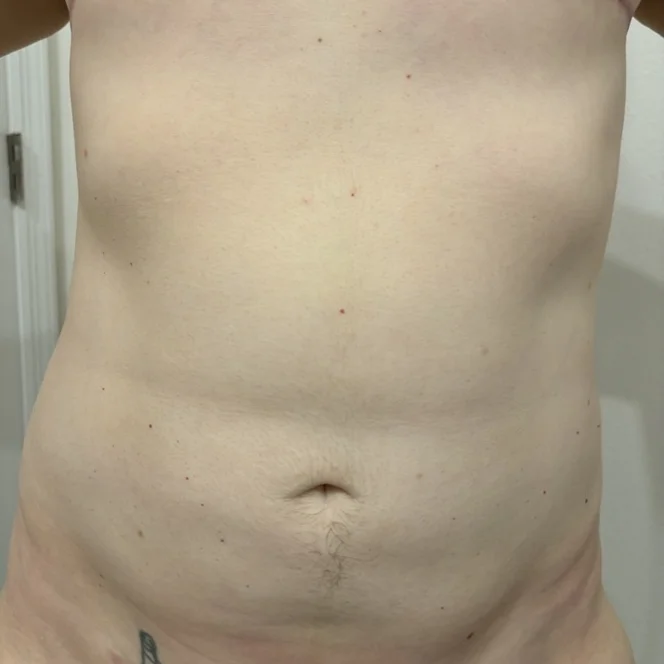 torso-masculinization-4