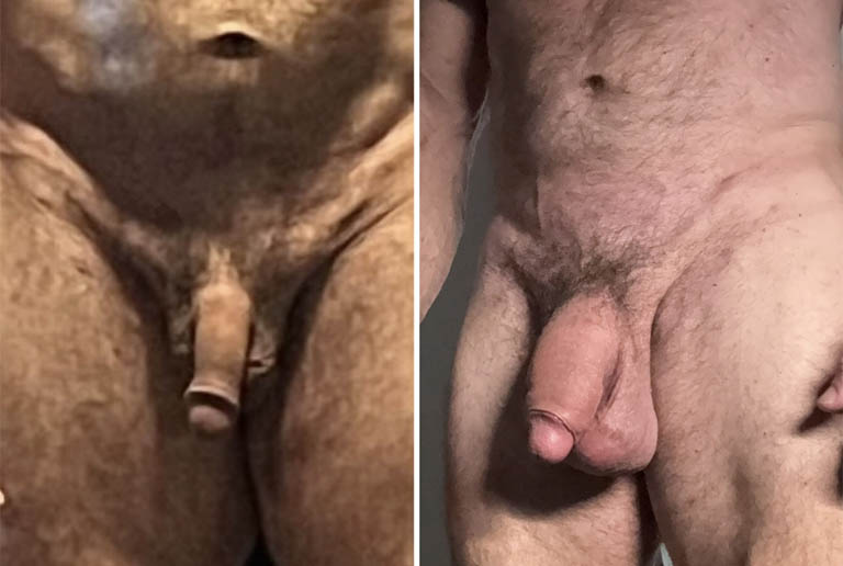 1_0000_testicle 1.JPG