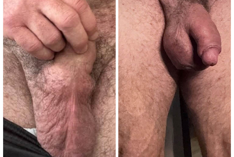 1_0001_testicle 2.JPG