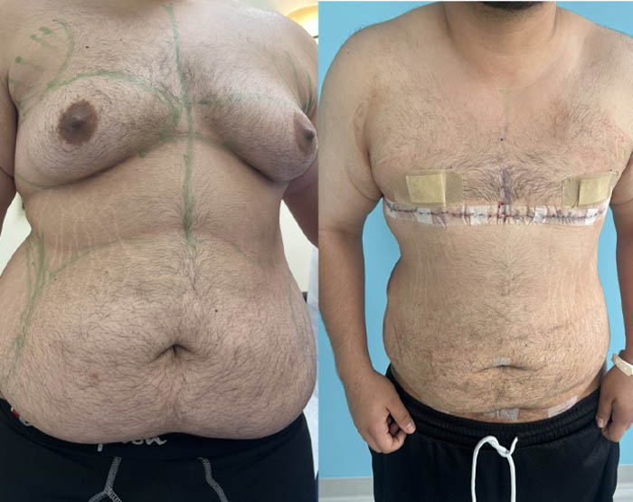 1_0001_torso masc 3.JPG