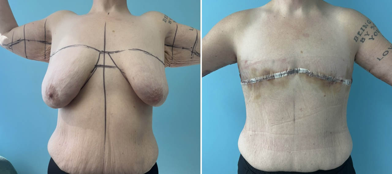 1_0002_top gun frnt.JPG