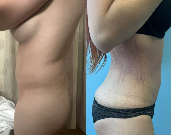 1_0002_torso fem 3.JPG