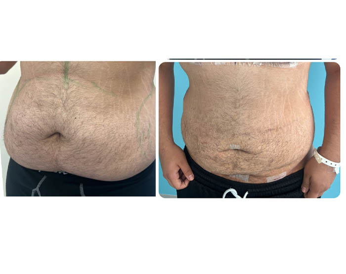 1_0002_torso masc 2.JPG