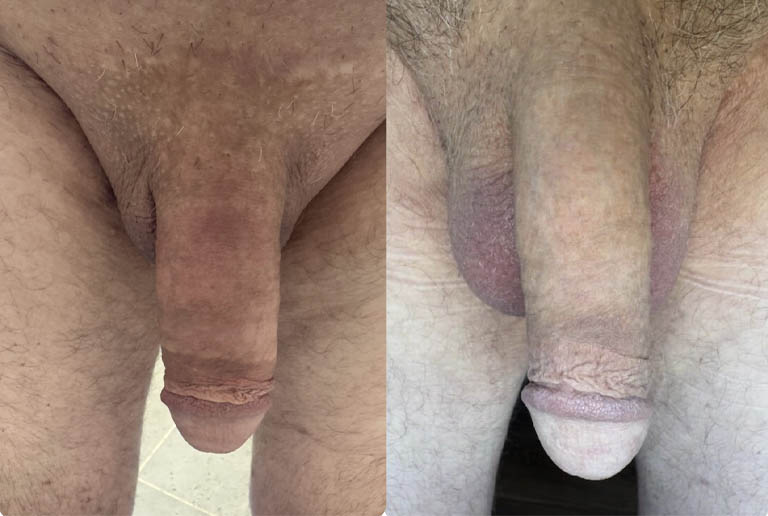 1_0003_testicle 4.JPG