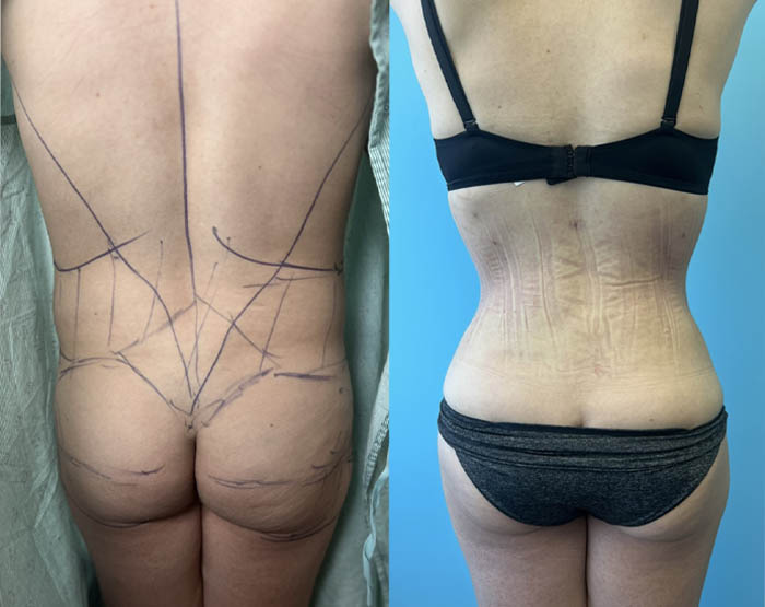 1_0003_torso fem 4.JPG