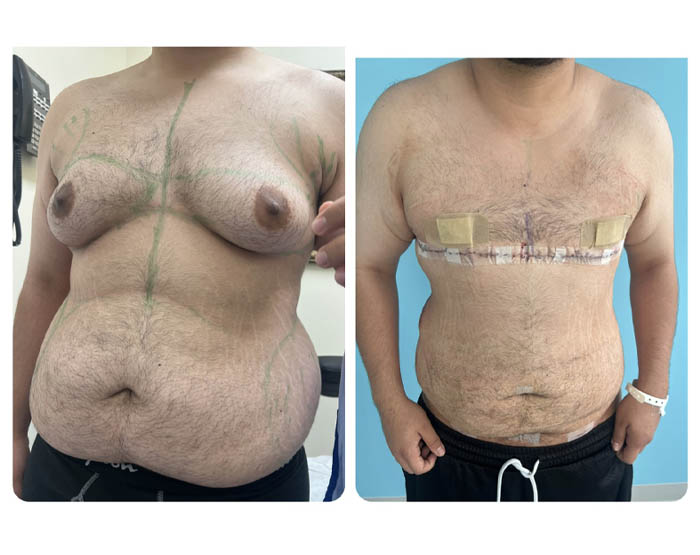 1_0003_torso masc 4.JPG