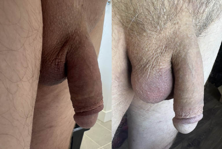 1_0004_testicle 5.JPG