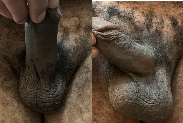 1_0005_testicle 7.JPG