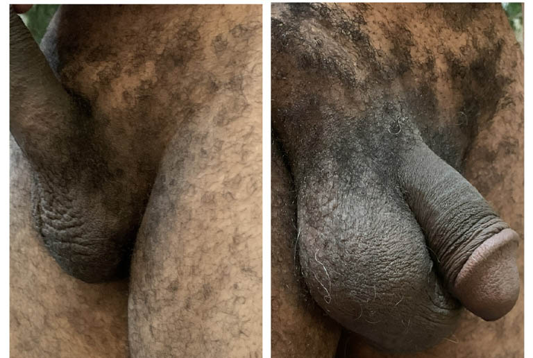 1_0006_testicle 8.JPG