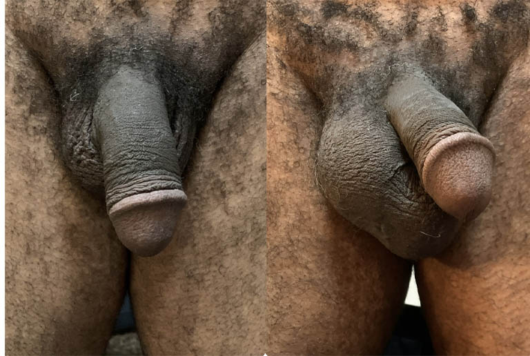 1_0007_testicle 9.JPG