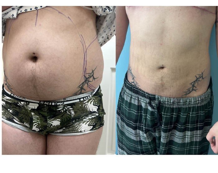 1_0008_torso masc 9.JPG