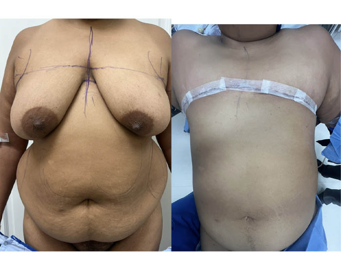 1_0009_torso masc 11.JPG