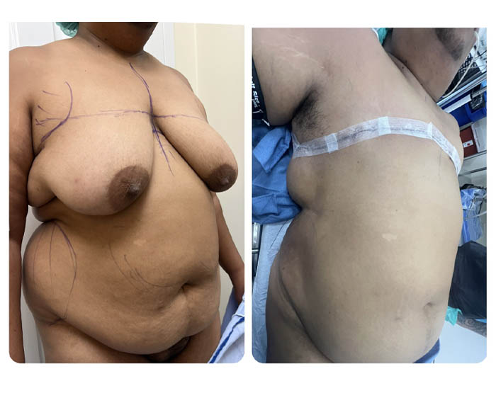 1_0010_torso masc 12.JPG