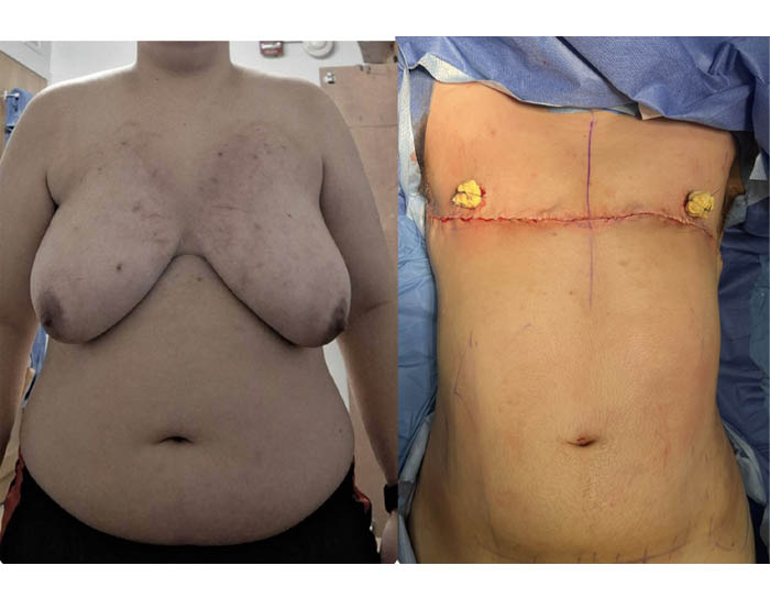 1_0013_torso masc 21.JPG